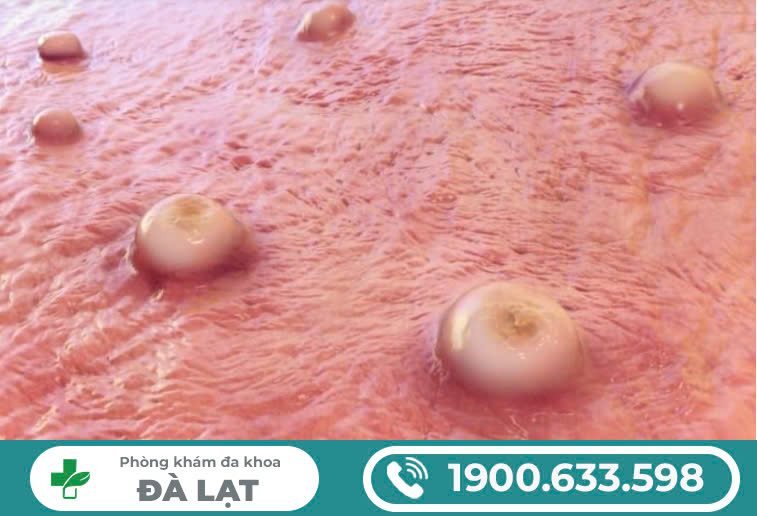 Hình ảnh minh họa